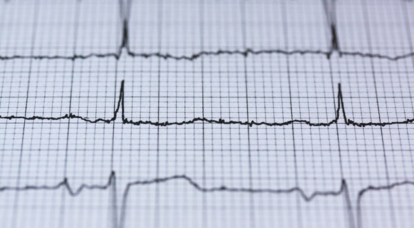 Doctor's At Medanta Do It Again:  World’s Smallest Pacemaker Implanted In A 92-Year-Old Man.